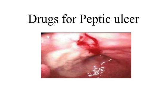 Drugs for Peptic Ulcer - Pathophysiology, Mechanism of action | PPTX