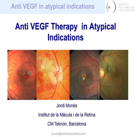 Anti vegf in atypical indications (2)