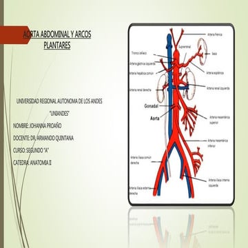 Aorta abdominal y arcos plantares