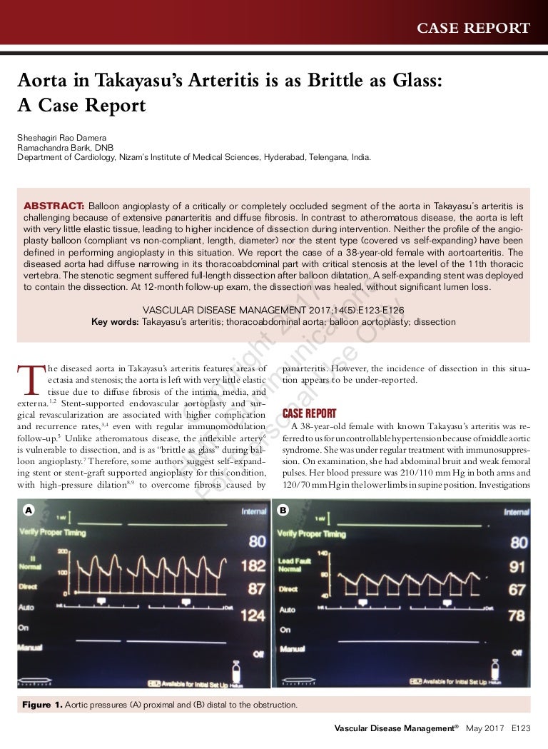 Aorta In Takayasu S Arteritis Is As Brittle As Glass aorta in takayasu s arteritis is as
