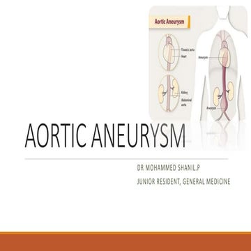 AORTIC ANEURYSM.pptx