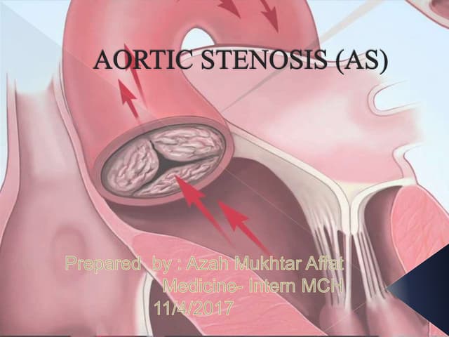 J POINT IN ECG AND ITS INERPRETATION IN ECG | PPTX