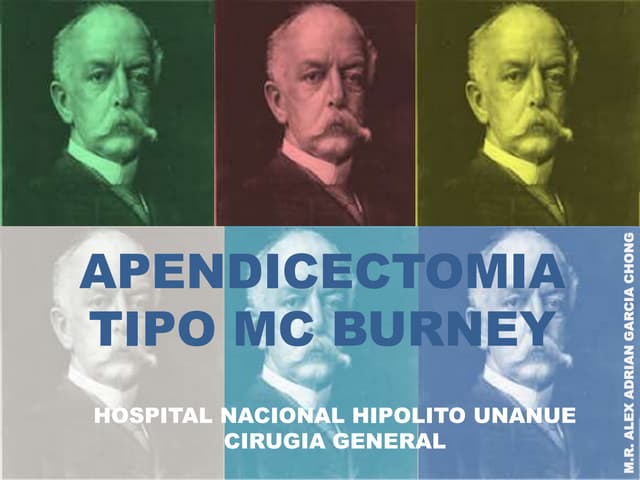 Apendicectomia Tipo Mc Burney