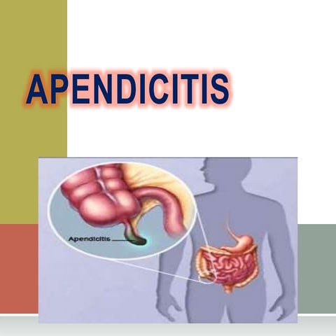 Apendicitis Aguda