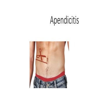 Apendicitis. Cuidados de Enfermería
