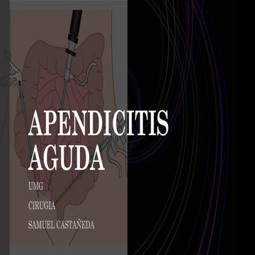 Comprehensive Overview of Acute Appendicitis: Diagnosis, Treatment, and ...