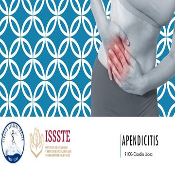 Comprehensive Overview of Appendicitis: Pathophysiology, Diagnosis, and ...