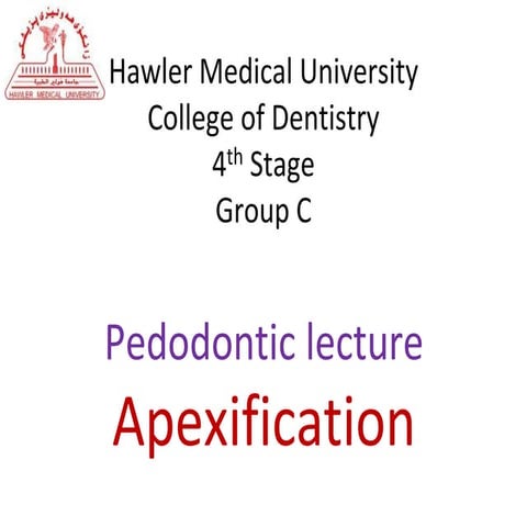 Apexification | PPTX