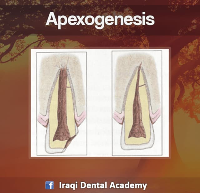 Apexogenesis & apexification | PPTX