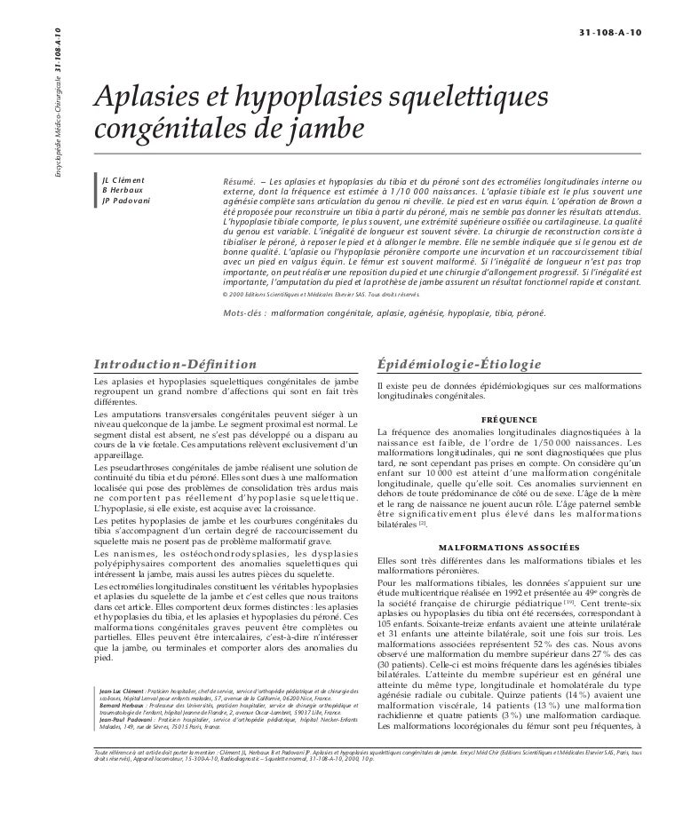 Aplasies Et Hypoplasies Squelettiques Congenitales De Jambe