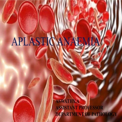 Aplastic Anaemia