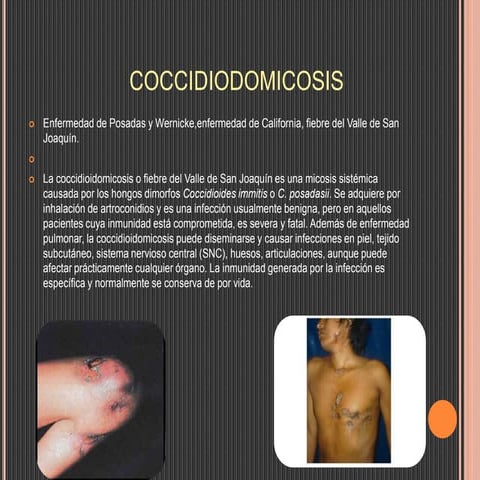 Aplicación de tecnicas micologicas (coccidioidomicosis)