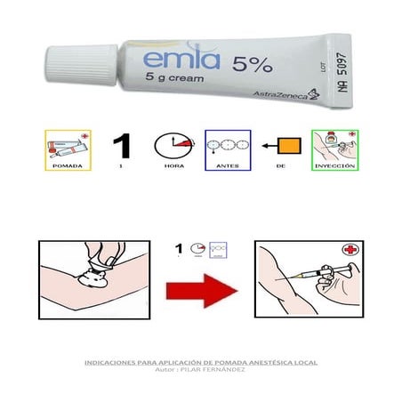 Aplicación pomada anestésica