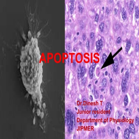 Apoptosis