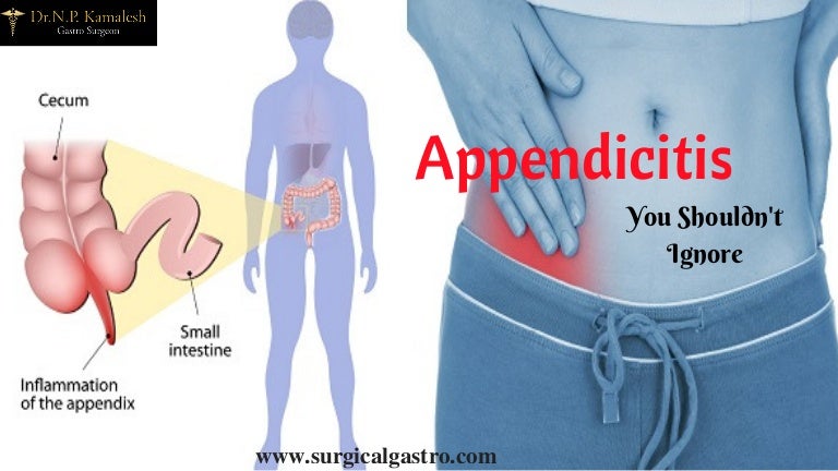 Appendicitis Treatment In Kerala