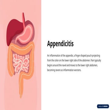 Appendicitis | PPT