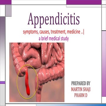 Appendicitis - a detailed medical study | PPTX