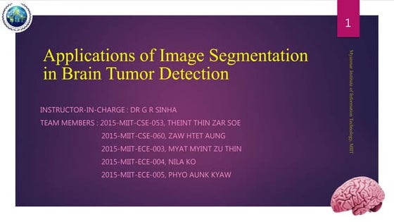 Brain tumor detection using image segmentation ppt | PPT