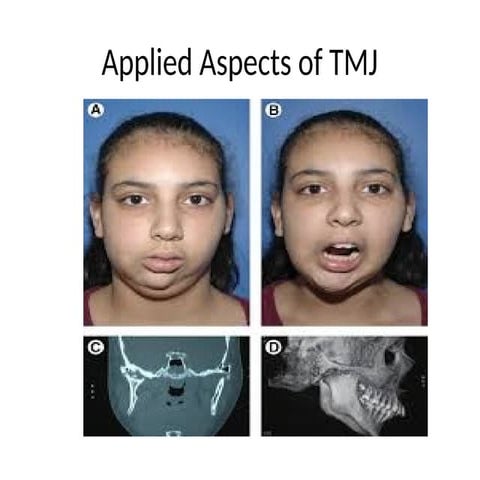 Comprehensive Overview of Temporomandibular Joint: Anatomy, Disorders ...