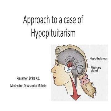 Approach to a case of Hypopituitarism.pptx