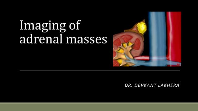 Approach to adrenal lesions