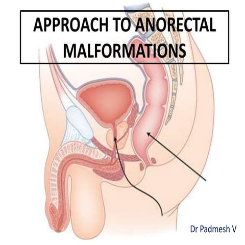 Approach to Ano Rectal Malformations - Dr Padmesh - Neonatology
