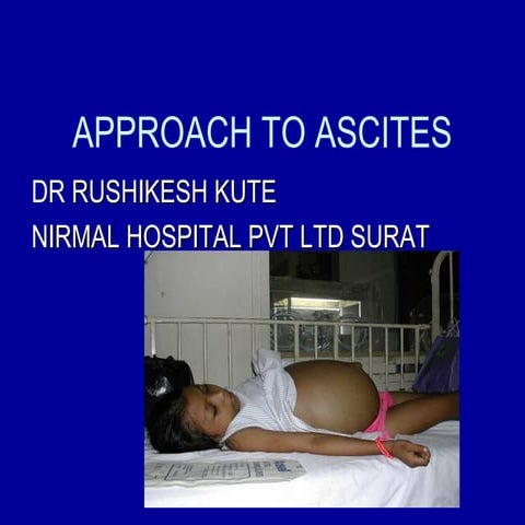 Approach to ascites
