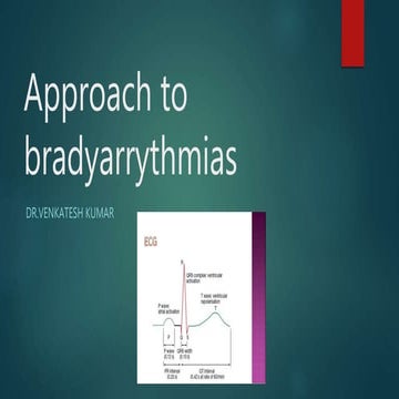 Approach to bradyarrythmias1