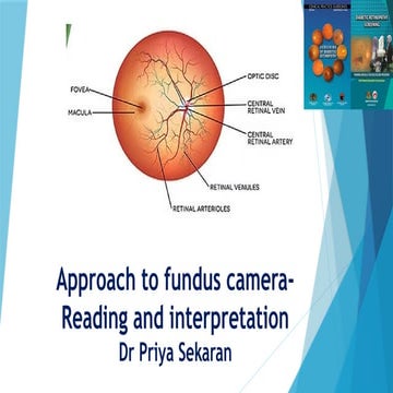 Basic fundoscopy | PPTX