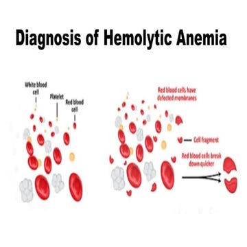 Diagnosis of hemolytic anemia
