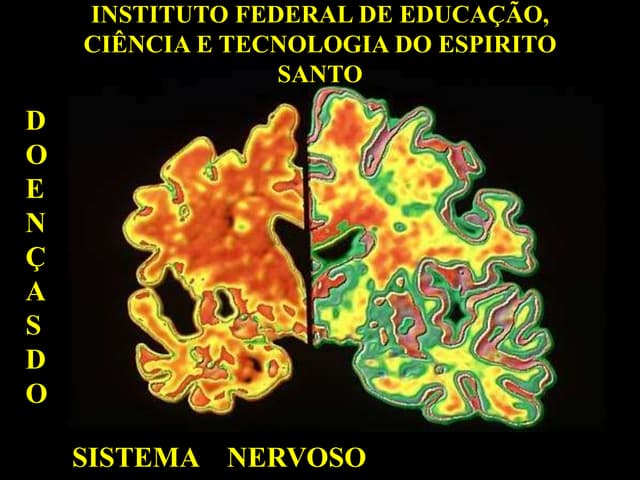 sistema nervoso 