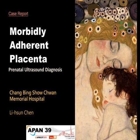 Morbidly Adherent Placenta (for APAN39)
