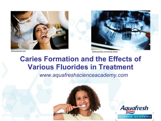 Aquafresh Science Academy Fluoride Slide Set