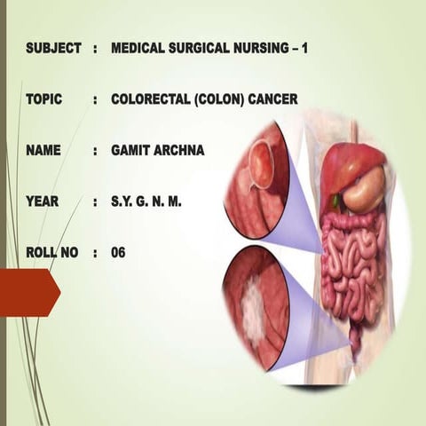 Archna PPT.pptjjdjbdhdjjdjdhdjhdhudhdhhdhdhd