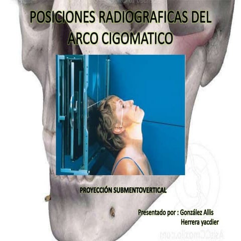Rx de mandibula | PPTX