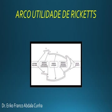 Comprehensive Guide to Ricketts Utility Arch in Orthodontics | PDF