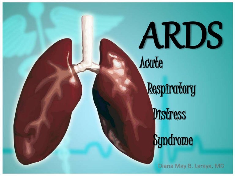 Ards