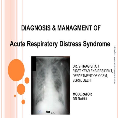 ARDS - Diagnosis and Management