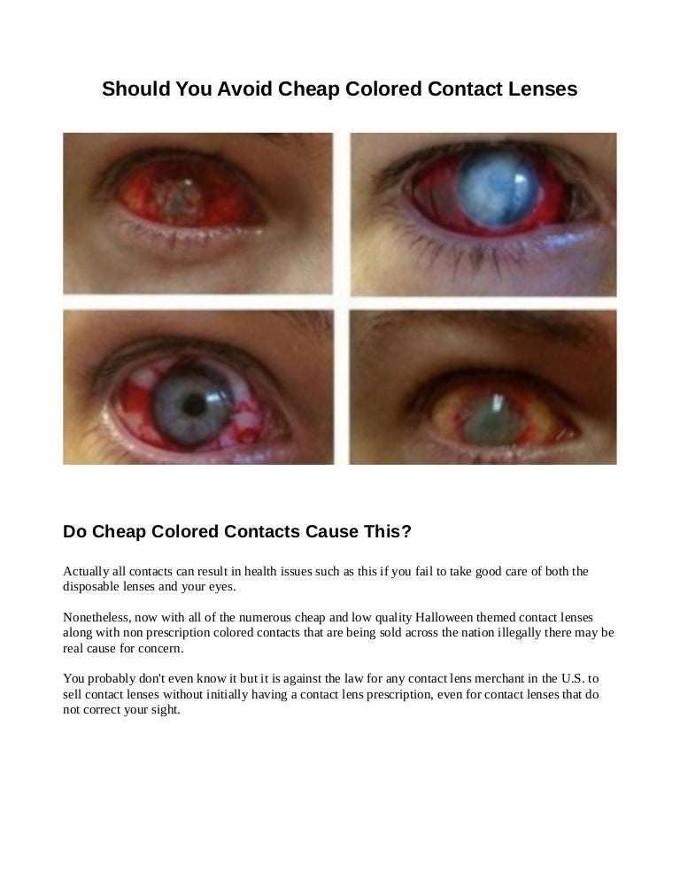 Non Prescription Colored Contacts >> Are Cheap Colored Contacts Dangerous Non Prescription Colored Contacts >> Are Cheap Colored Contacts Dangerous