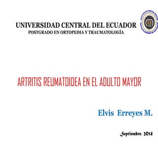 Artritis Reumatoidea en el Adulto M...