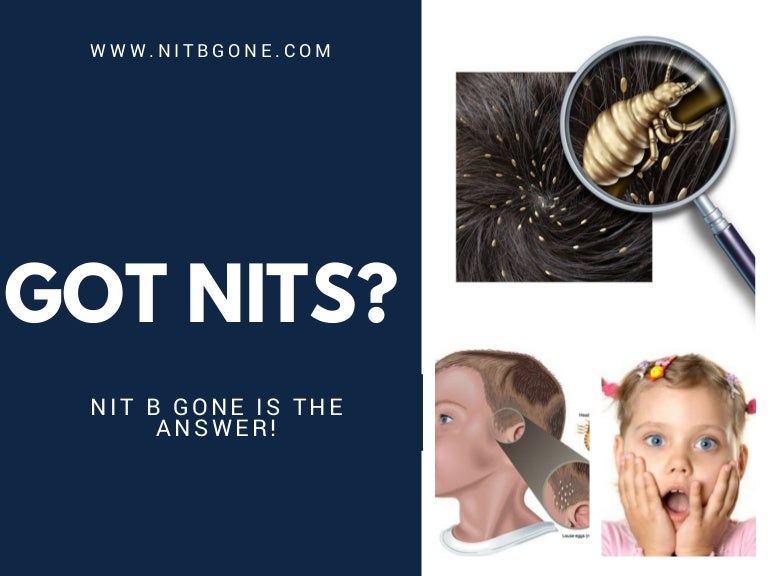 Are you suffering from nits or lice?