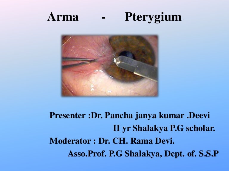 Arma pterygium