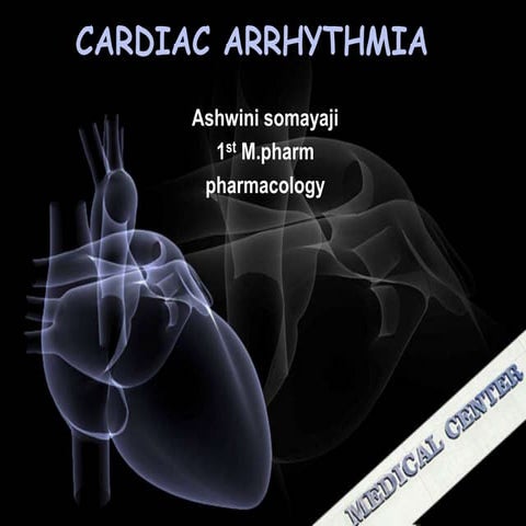 Arrhythmia 