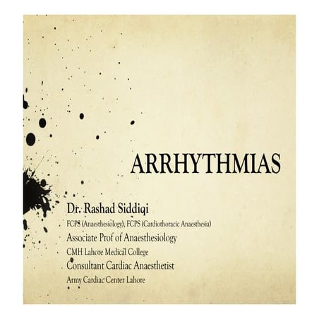 Arrhythmias