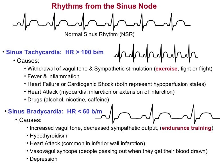 Arrhythmias19