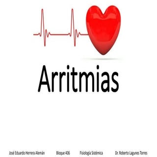 Arritmias