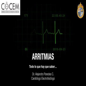 Arritmias