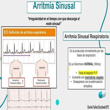 Arritmia Sinusal.pptx