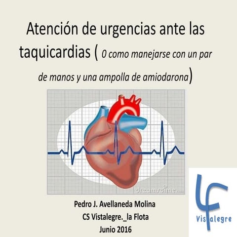 Manejo de las arritmias frecuentes en el centro de salud