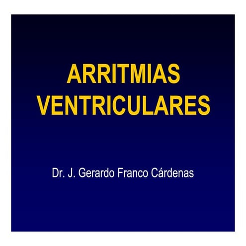 Arritmias Ventri